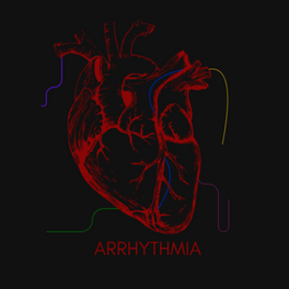Arrhythmia