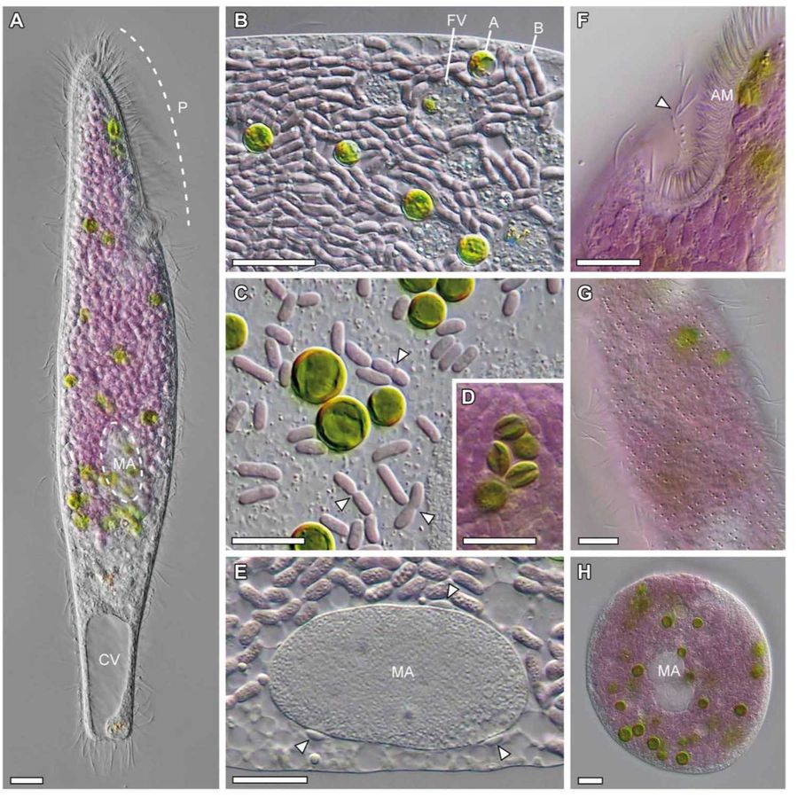 Papers Aloud 16 A microbial eukaryote with purple bacteria and